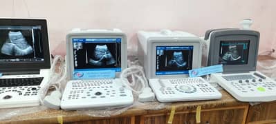 Brand new Ultrasound machine Chinese (with or without battery backup)