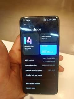 MI 11 lite