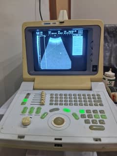 Ultrasound Machine Chison 600M