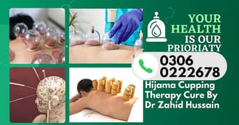 Hijama Cupping Therapy & Acupuncture Cure By Dr Zahid Hussain DHA Raya