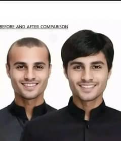 Full head Cap Wig for men - Dark Brown Shine ( China)