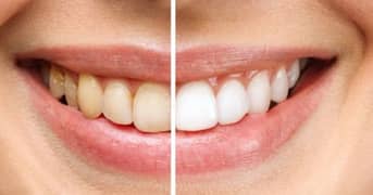 Female Dental Assistant