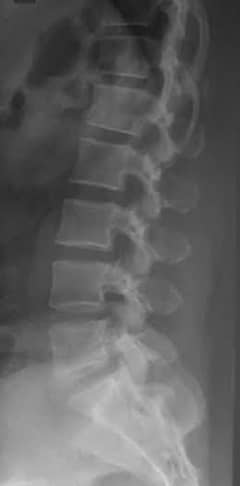 Need Radiologist
