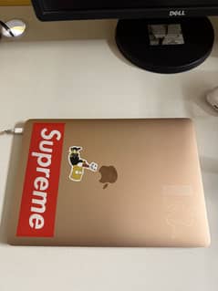 MacBook