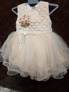 Baby frock