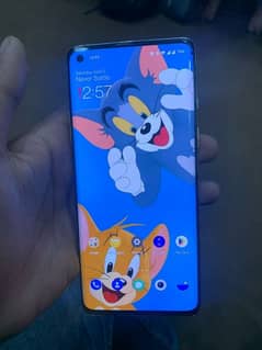 OnePlus 8 Dual sim pachh screen ma shade hay or minor dot