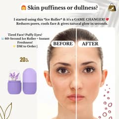  Ice Roller for Instant Glow | Shrinks Pores | Cool & Safe 