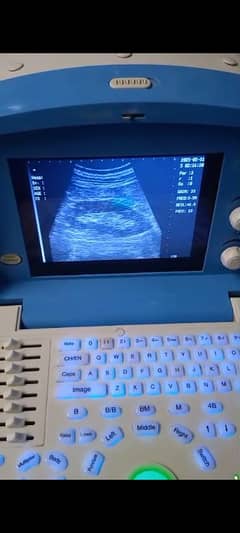 ultrasound