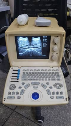 Used Chinese Ultrsound Belson / Chison
