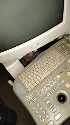 Aloka ProSound SSD-3500 Ultrasound Machine – Good Condition
