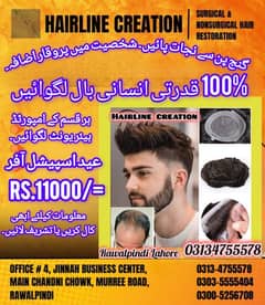 hair units wigs hair restoration Hair extensions
