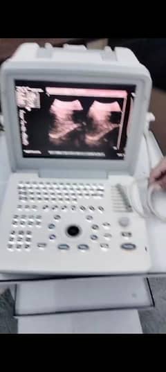 ultrasound machine with stand urgent sale