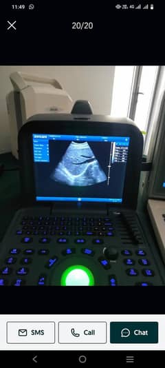 ultrasound