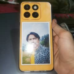 ZTE