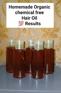 hairfall