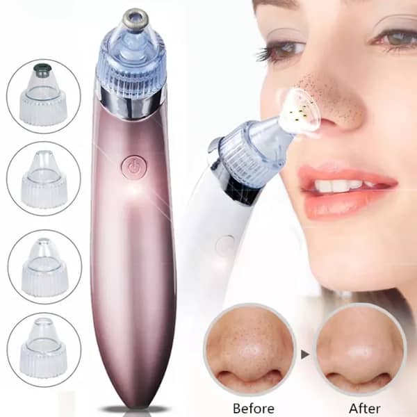 5-in-1 Blackhead Vacuum Pore Cleaner by [Brand Name] - Rechargeable Device for Facial Exfoliation and Acne Treatment