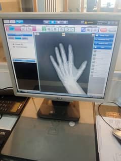 Digital x-ray Machine
