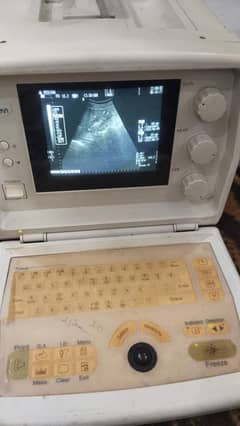 Ultrasound