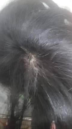 human hair wig extension for bald girls