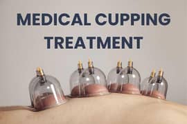 Hijama