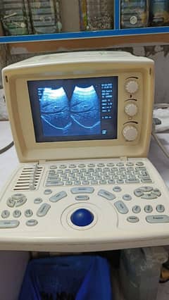 Ultrasound