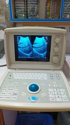 ultrasound
