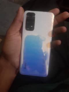 Redmi note 11 exchange possible