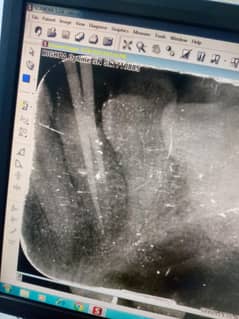 i am dental assistant