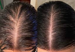 Hair