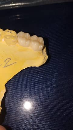 Dental Designer and Marketing person of lab