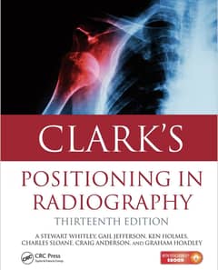 CLARKS Positioning in radiography.