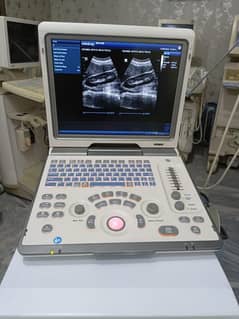 ultrasound