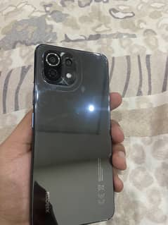 MI 11 lite