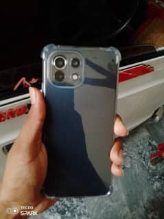 Xiaomi mi 11 lite