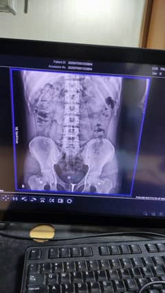 Digital x-ray Machine
