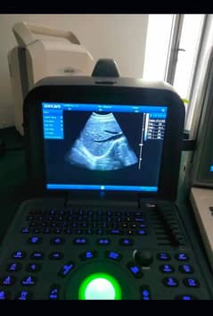 ultrasound machines - Portable ultrasound |Color ultrasound
