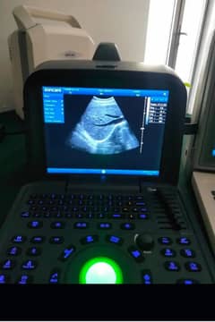 Brand new ultrasound machines - Portable ultrasound |Color ultrasound