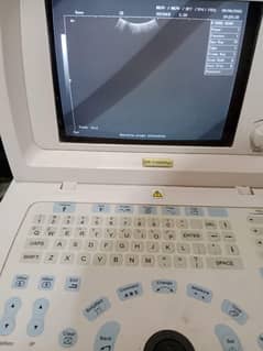 Ultrasound Machine