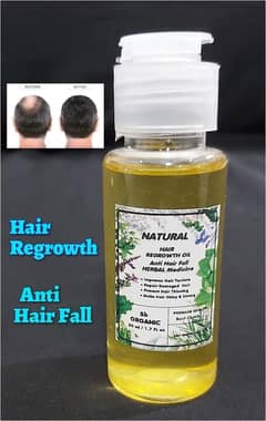 Hair Regrowth organic oil , Anti Hair fall, Anti Dendruf oil . 30 ml