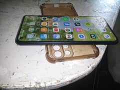 MI 11 lite