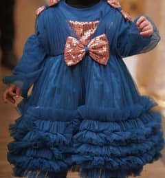 Baby frock