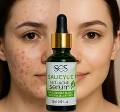 acne serum