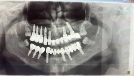 Dental assistant