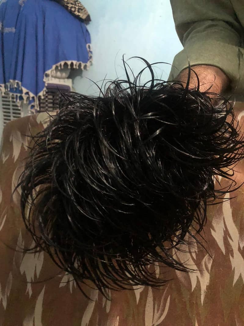 hair patch 2