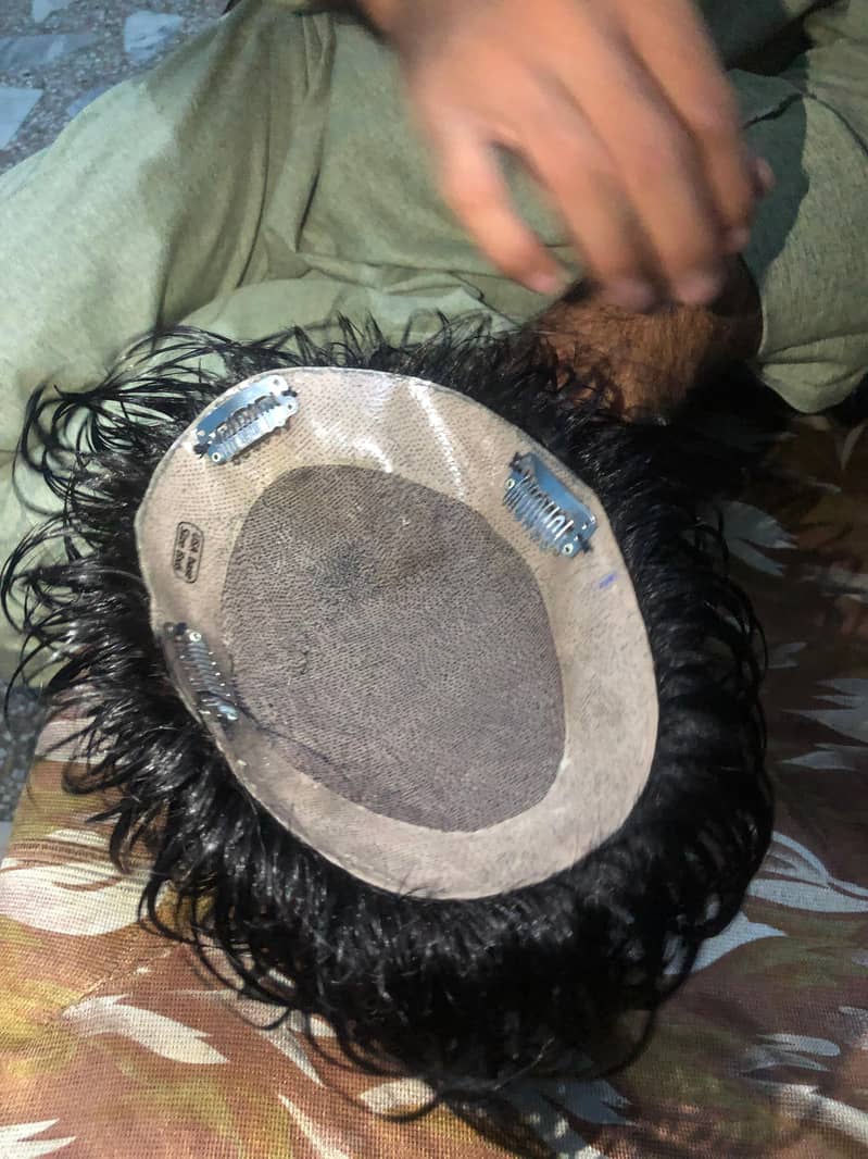 hair patch 3