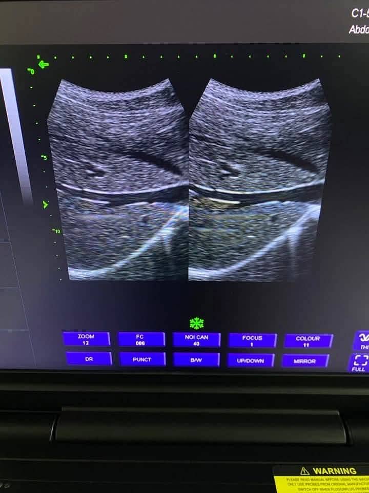 Ultrasound machine grey scale color doppler echo 6