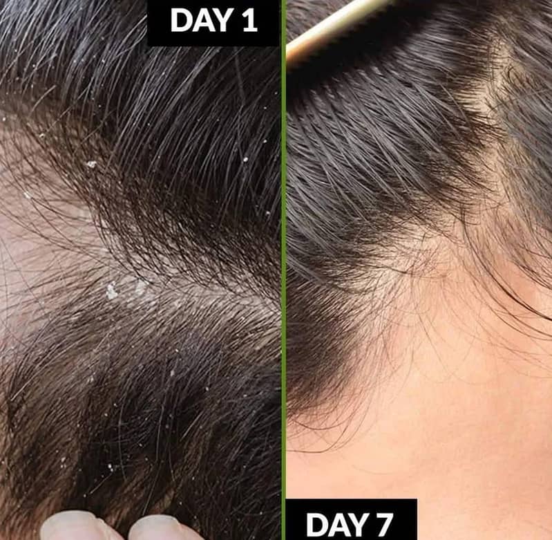 صحت مند اور گھنے بالوں کاراز  یہ آئل بالوں کو جڑوسے مضبوط بناے 4