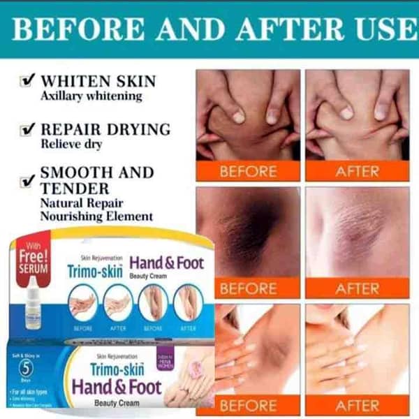Hand and Foot Whitening Medicated Cream For All Skin Types
