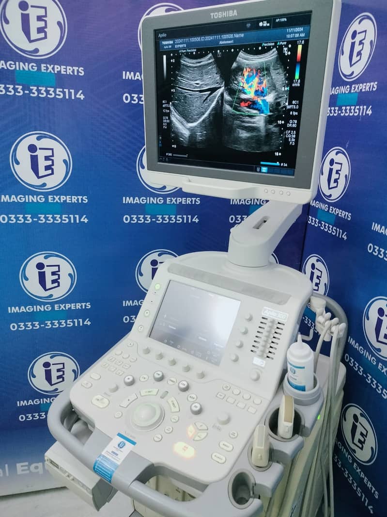 1. Toshiba Aplio 300 Platinum (Shearwave Elastography + Convex & Line 1