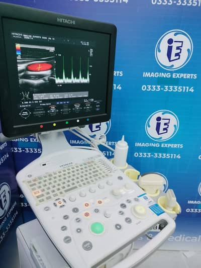 Ultrasound Machine Toshiba Aplio 300 Toshiba Xario Prime japan Facuda